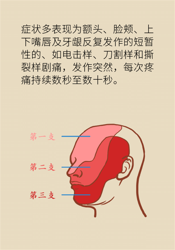 這種疼痛不是牙疼？緩解三叉神經(jīng)痛就用這兩招